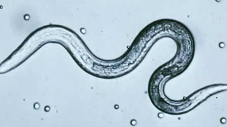 Pinworm Infection Causes Symptoms Diagnosis Treatments Entirely