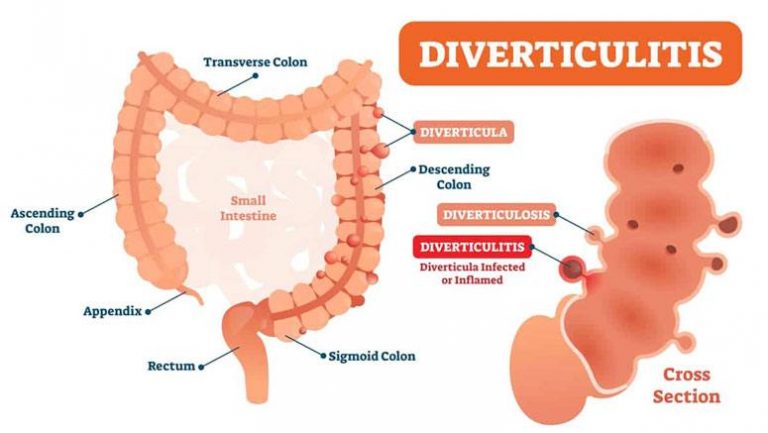 facts-about-pain-in-left-side-of-belly-button-entirely-health