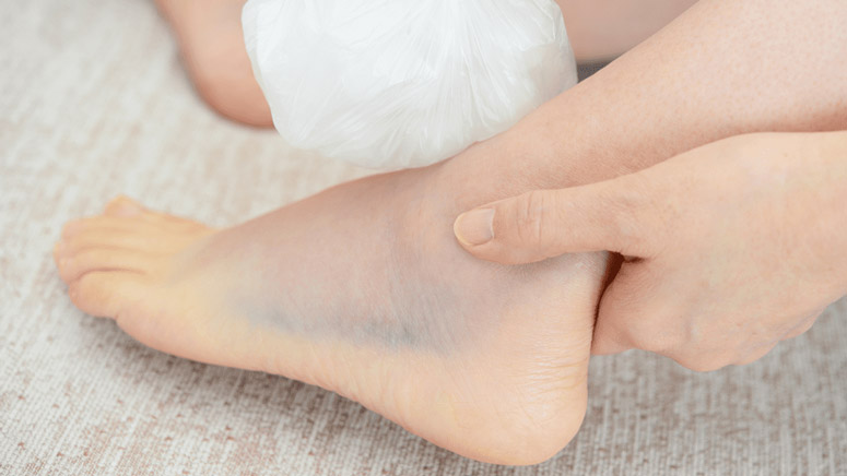 Causes of Swollen Ankles – Page 6 – Entirely Health