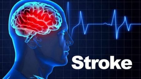 Stroke Signs and Symptoms – Entirely Health