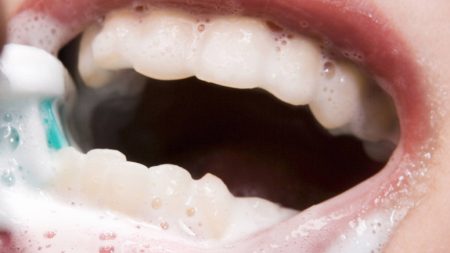 Home Remedies for Abscess Tooth – Page 9 – Entirely Health