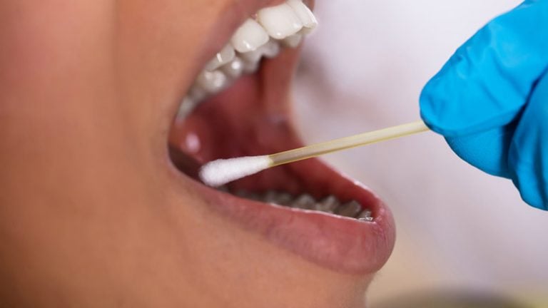 Home Remedies for Abscess Tooth – Page 8 – Entirely Health