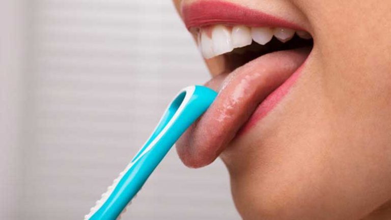 10 Effective Remedies of Dry Mouth – Page 3 – Entirely Health