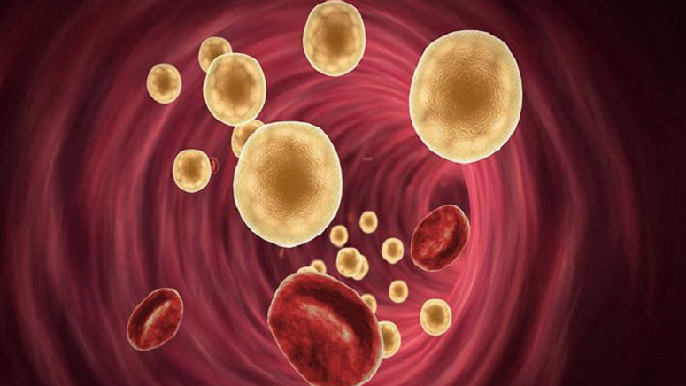 8 Common Causes of Fatty Liver Disease – Page 5 – Entirely Health