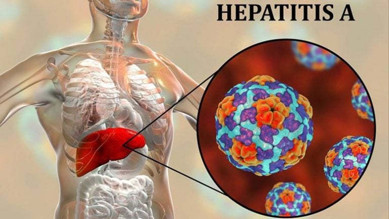 Signs Symptoms Of Hepatitis A Entirely Health
