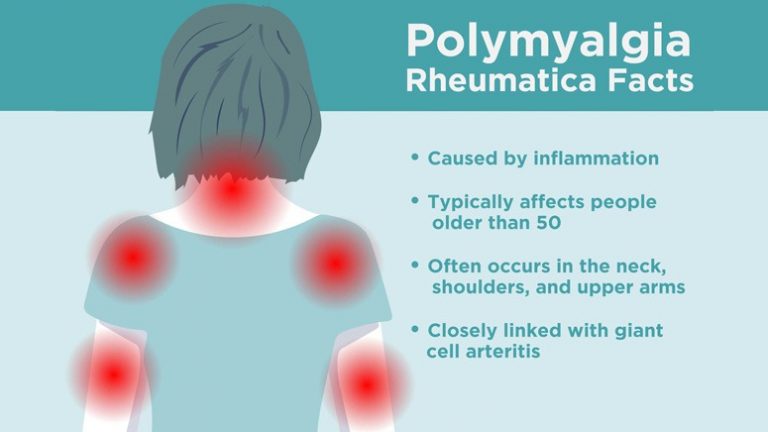 Polymyalgia Rheumatica Diet: Foods to Eat and Avoid – Entirely Health