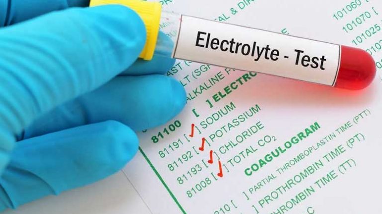 7 Main Causes of Seizures – Page 7 – Entirely Health