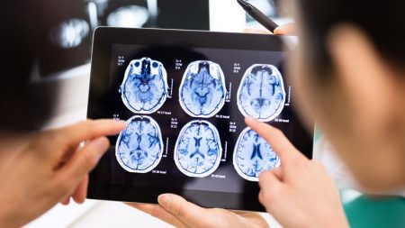 7 Signs and Symptoms of Brain Tumor – Page 8 – Entirely Health