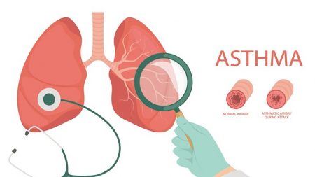 Common Treatments for Severe Asthma – Entirely Health