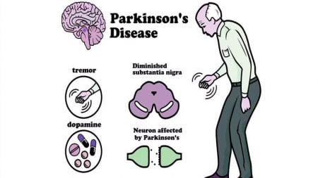 10 Early Signs of Parkinson’s Disease – Entirely Health