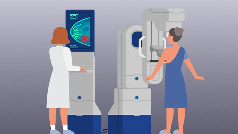 What are the Recommendations for Breast Cancer Screening? – Entirely Health