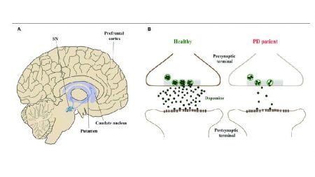 Dopamine and Parkinson Disease- What to Know – Page 3 – Entirely Health