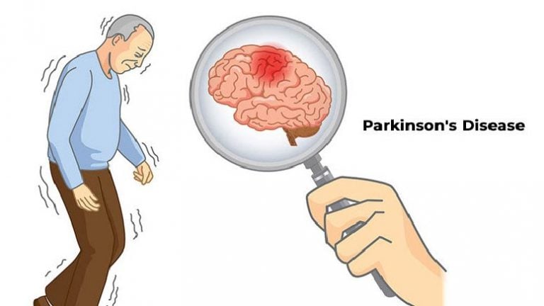 Dopamine and Parkinson Disease- What to Know – Entirely Health