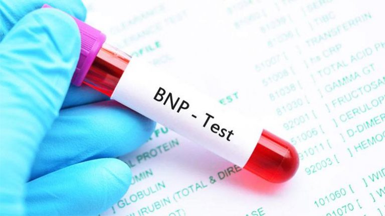 B-Type Natriuretic Peptide (BNP) Test – What To Know – Entirely Health