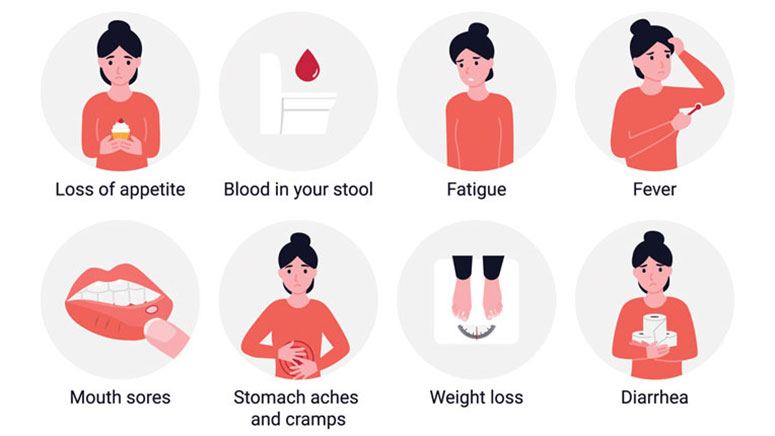 Fatigue in Inflammatory Bowel Diseases (IBD) – Facts to Know – Page 2 ...