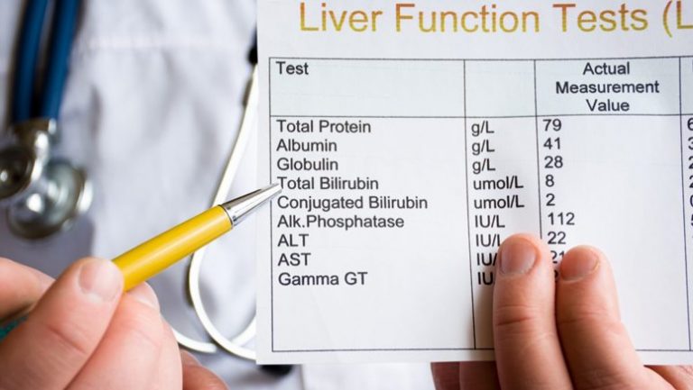 what-causes-high-bilirubin-levels-entirely-health