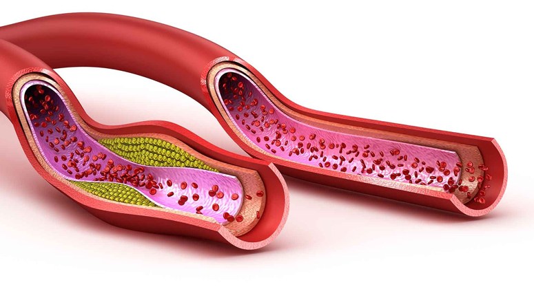 how-do-i-lower-my-cholesterol-common-ways-to-know-page-8-entirely