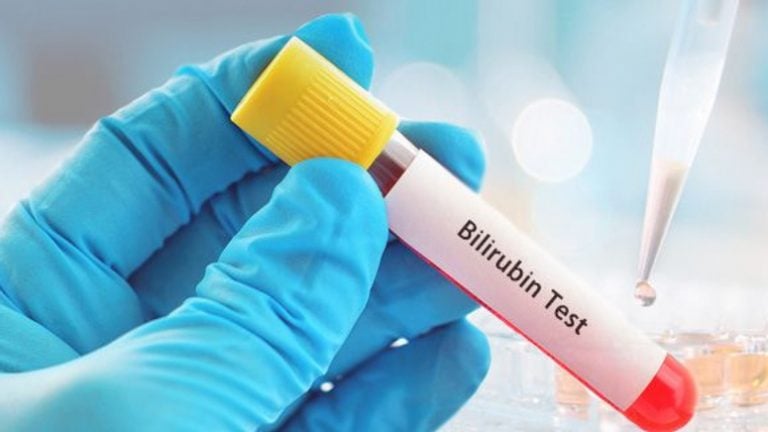 Bilirubin Test High Vs Low Levels What To Know Page 4 Entirely Health 8384