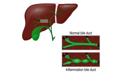 What Causes High Bilirubin Levels? – Page 7 – Entirely Health