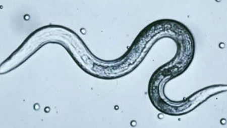 Pinworm Infection: Causes, Symptoms, Diagnosis & Treatments – Entirely ...