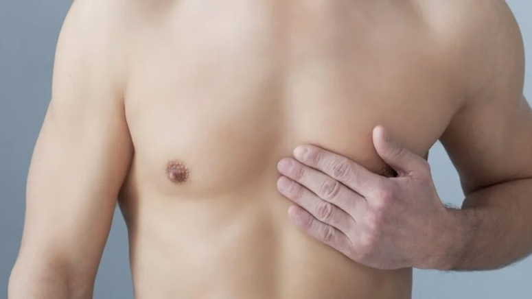 8 Common Causes Of Gynecomastia Entirely Health