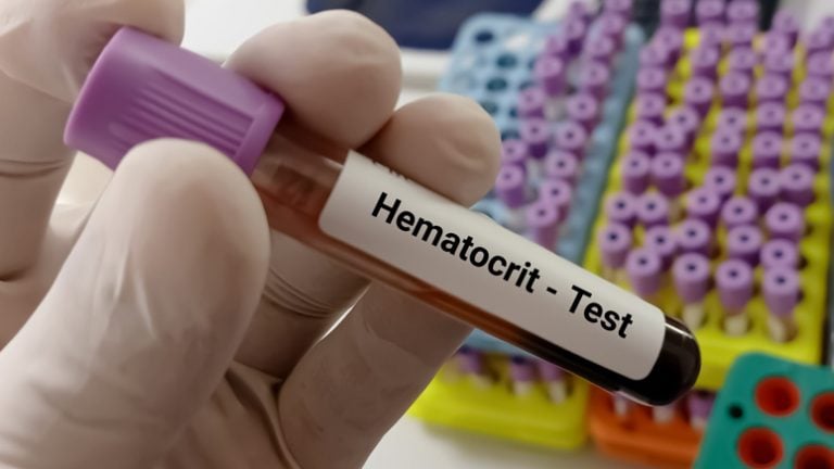 Hematocrit Test What It Is Levels High And Low Rang Entirely Health