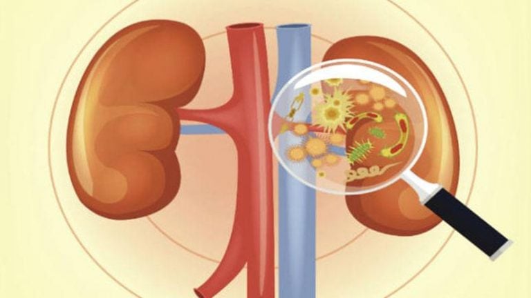 10-most-common-causes-of-kidney-infection-entirely-health