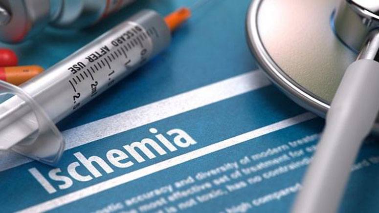 ISCHEMIA SYMPTOMS CAUSES TREATMENTS AND PROGNOSIS visual data 6